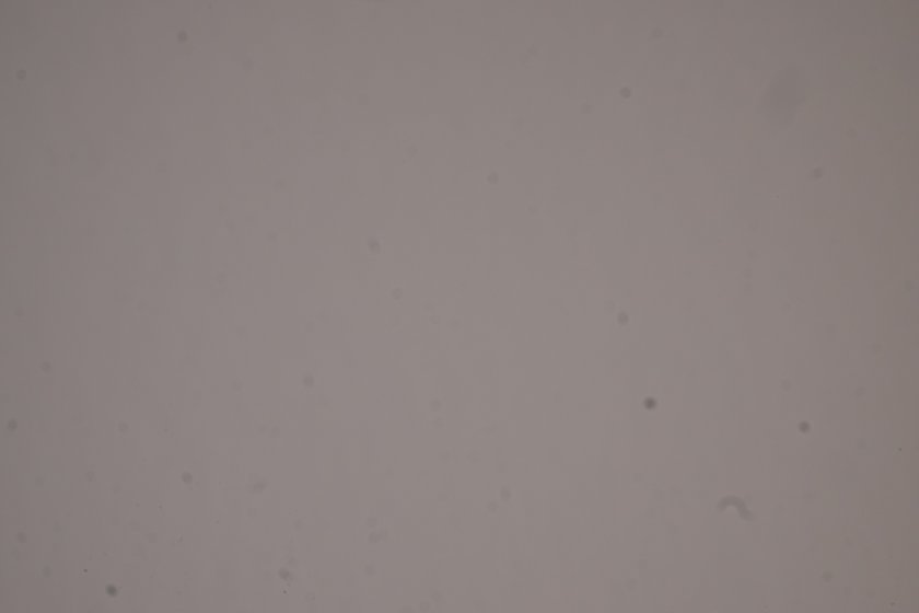 Filtering Dust Note Dust under AA filter? | DPReview Forums