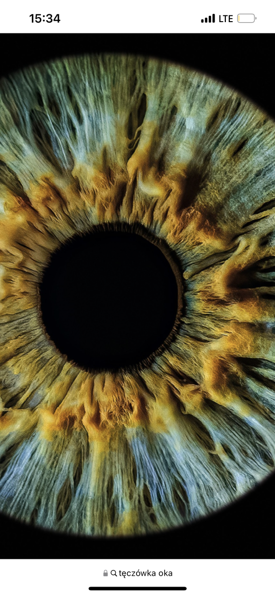 Technique for high-res iris macro (focus stacking + lighting ...
